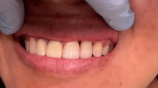 Brighton Oral & Maxillofacial Surgery - Excellence in Facial Reconstruction