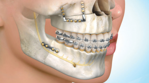 Exploring Thesis Topics for Oral and Maxillofacial Surgery