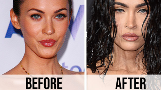 Megan Fox Before and After Plastic Surgery - An In-Depth Look