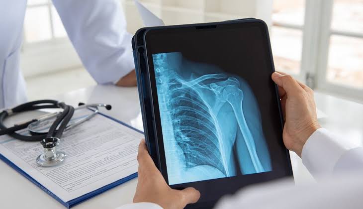 DR imaging